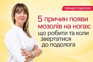 5 причин появления мозолей на ногах: что делать и когда обращаться к подологу
