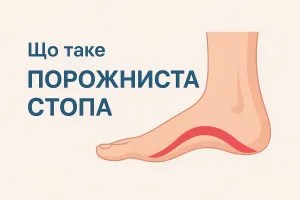 Що таке порожниста стопа: ознаки, як боротися з проблемою Що таке порожниста стопа: ознаки, як боротися з проблемою