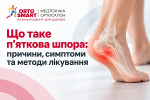 Что такое пяточная шпора: причины, симптомы и методы лечения Что такое пяточная шпора: причины, симптомы и методы лечения