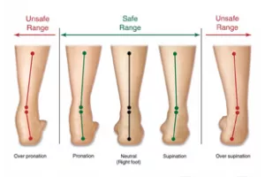 Восстановление голеностопного сустава после травм