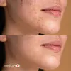 Апарат Дарсонваль Medica+LUX Darsoline 8.0, сірий - Фото№11