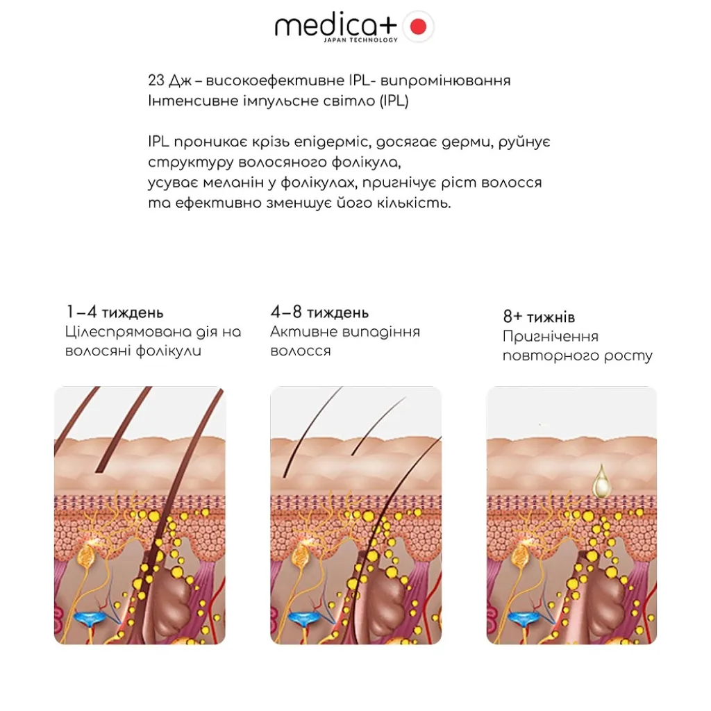 Фотоепілятор охолоджуючий Medica+ ICE PRO 10X Фотоепілятор охолоджуючий Medica+ ICE PRO 10X