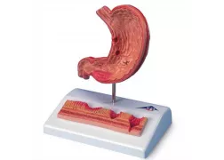 Анатомічна модель шлунка з виразками