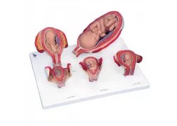 Стандартний набір моделей стадій вагітності, 5 моделей