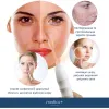Портативний дарсонваль Medica+ Darsoline 7.0 - Фото№8
