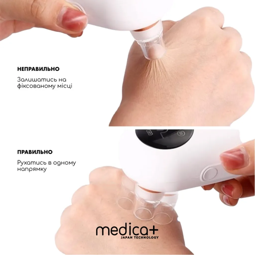 Вакуумний очищувач шкіри і пор Medica+ Skin Cleaner 7.0 Вакуумний очищувач шкіри і пор Medica+ Skin Cleaner 7.0