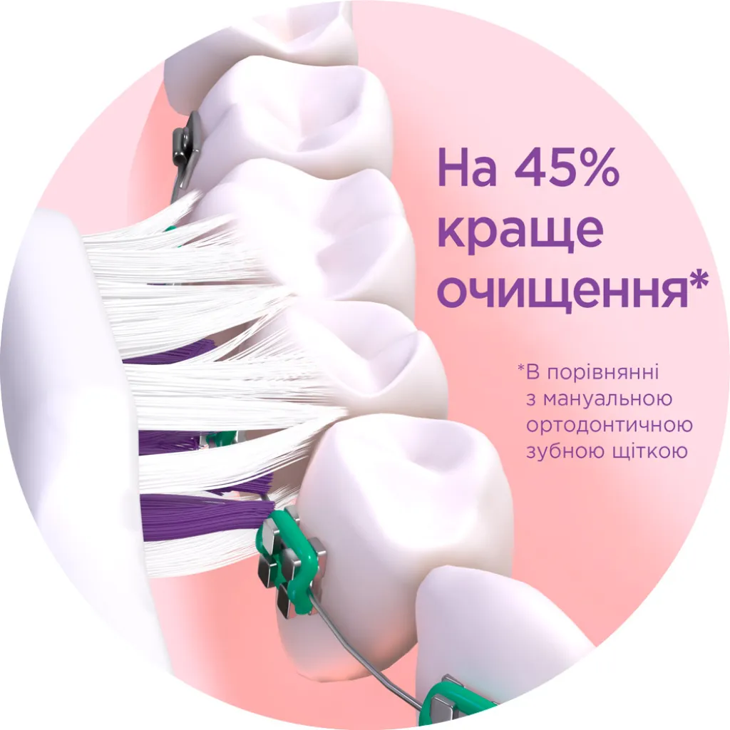 Насадки 4112BTM для зубной щетки GUM Sonic Ortho-4102BXM, (2шт)