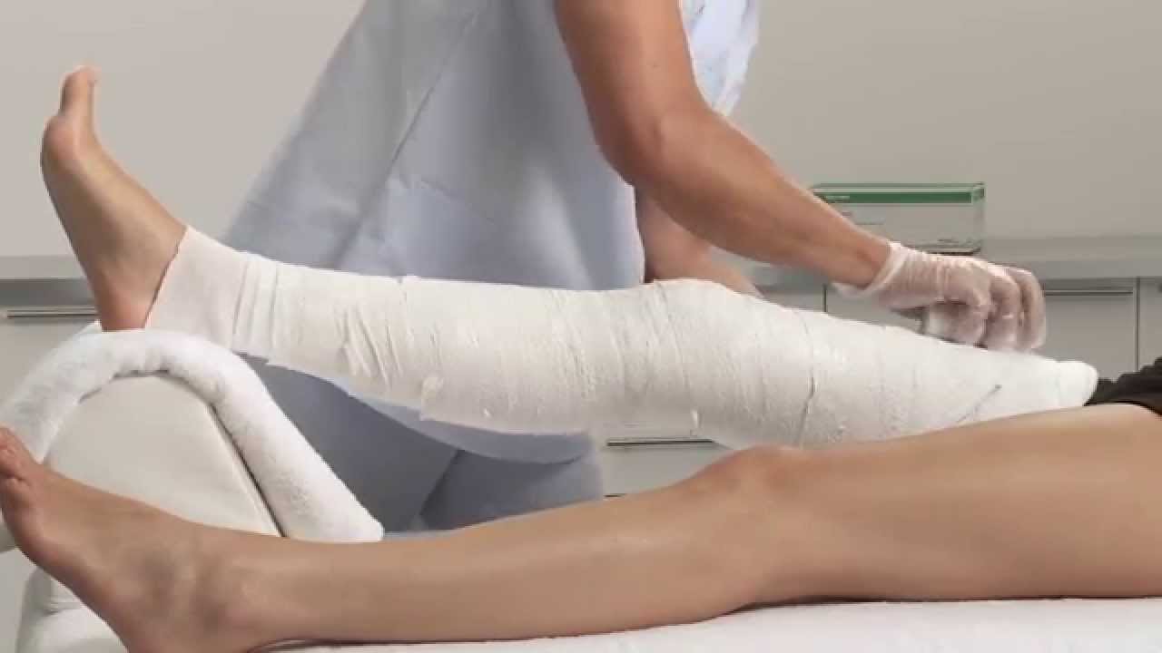 Сколько болит перелом ноги