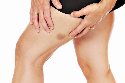 Возникновение боли в ноге в области от бедра до колена
