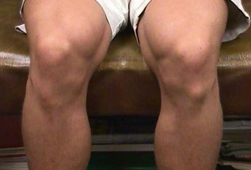 Ортезы на коленный сустав