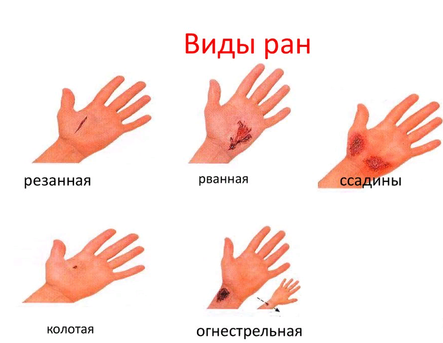 kako ukloniti bol od zglobovima ruku)